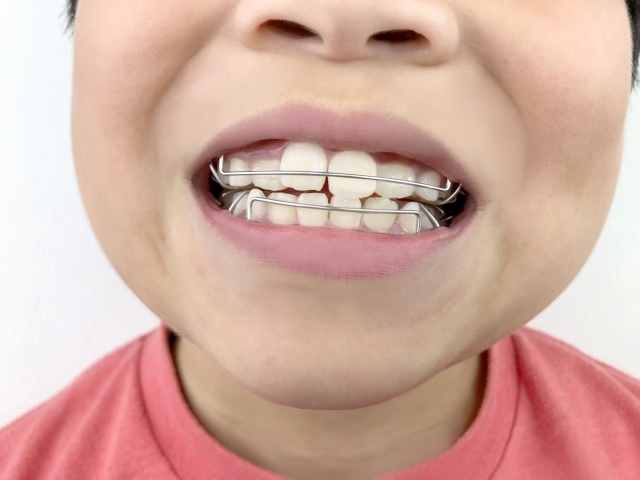 小児矯正 豊川市野口町おがわ歯科口腔外科 矯正歯科